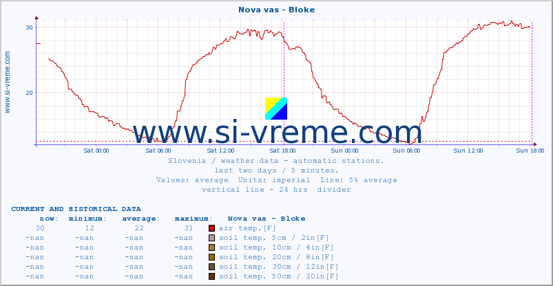  :: Nova vas - Bloke :: air temp. | humi- dity | wind dir. | wind speed | wind gusts | air pressure | precipi- tation | sun strength | soil temp. 5cm / 2in | soil temp. 10cm / 4in | soil temp. 20cm / 8in | soil temp. 30cm / 12in | soil temp. 50cm / 20in :: last two days / 5 minutes.